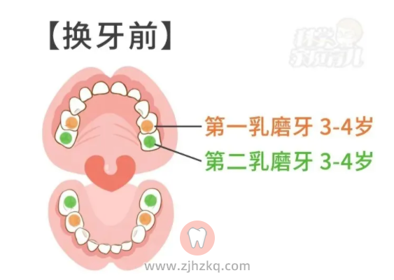 乳牙也要做窝沟封闭吗?