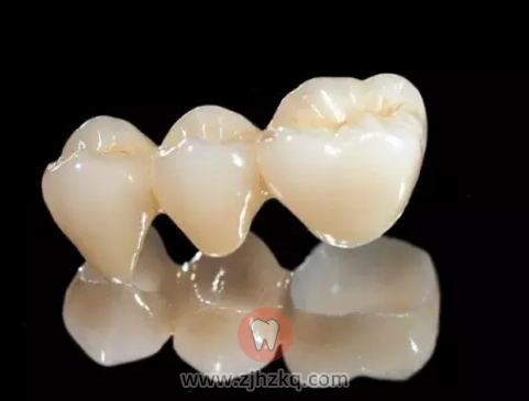 嵌体修复和传统补牙哪个好？