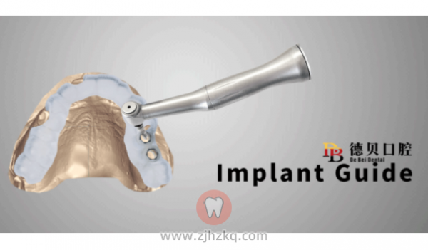 杭州德贝口腔种牙水平怎么样？