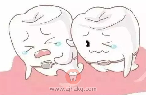 矫正牙齿副作用是什么有哪些？