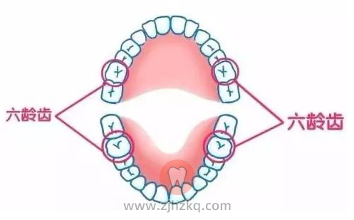 儿童六龄齿图片