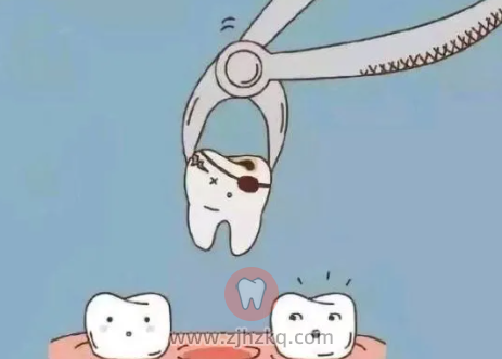 乳牙可以提前拔除吗？