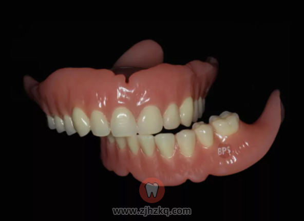 什么是BPS吸附性义齿