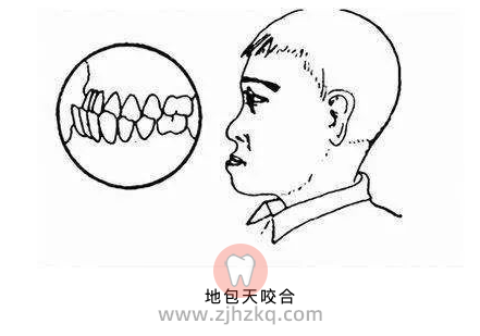 孩子牙齿矫正到底是几岁才可以？