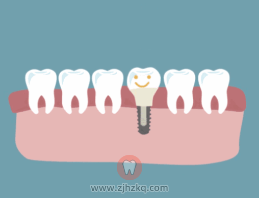 什么人不能种牙？