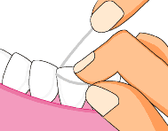 牙线会让牙缝变大吗？