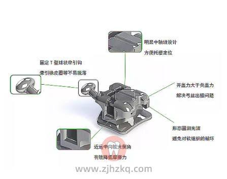 什么是自锁托槽？