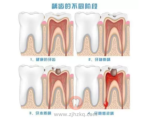有些人为什么会有口臭？