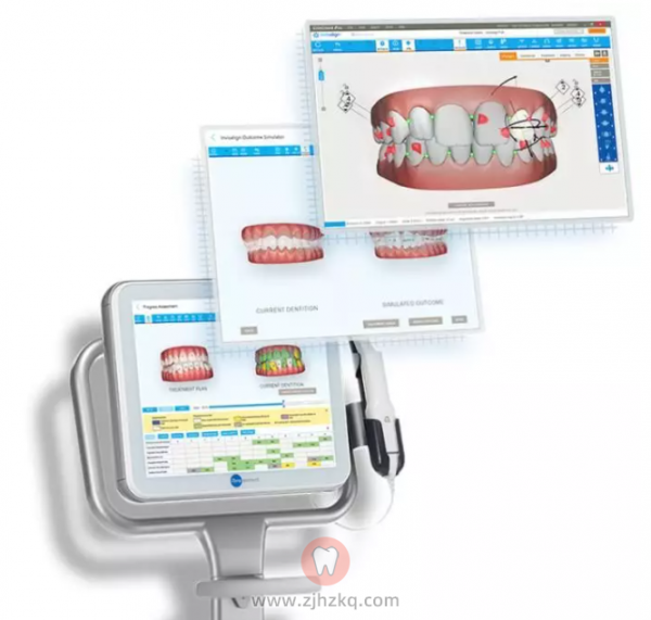 杭州隐形矫正就诊流程攻略