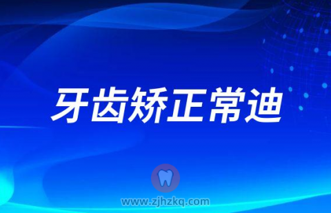 杭州青上牙齿矫正常迪