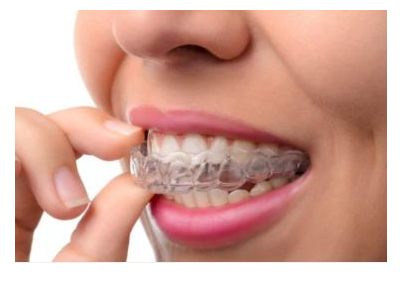 互联网体验店和网上买的隐形牙套品牌靠谱吗？