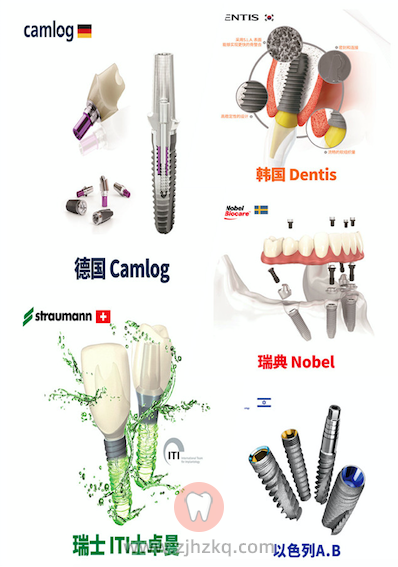 杭州种植牙哪个牌子最好最靠谱？