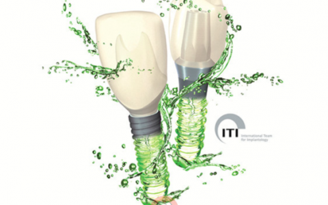 杭州士卓曼iti种植体用的人多吗?