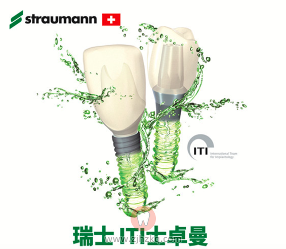 杭州士卓曼ITI种植体用的人多吗？