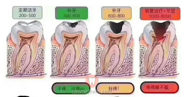 杭州牙齿做根管治疗收费标准