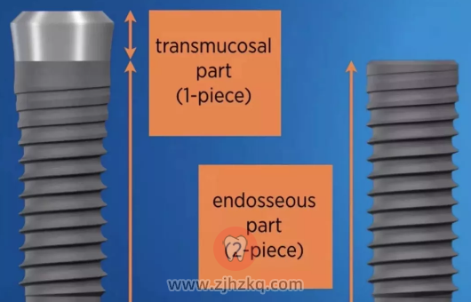 杭州一段式种植牙两段式种植体区别哪个好