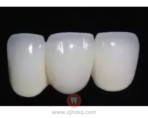 杭州全瓷牙牙冠口腔科普