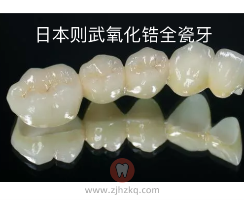 杭州日本则武全瓷牙多少钱一颗