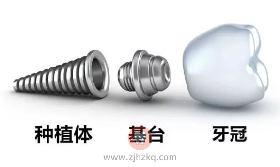 杭州种植牙技术好的医生排名推荐