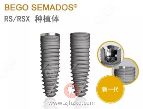 杭州口腔医院4999元种植牙怎么样可靠吗