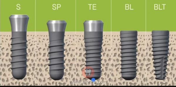 杭州牙科口腔瑞士士卓曼ITI种植体种植牙介绍