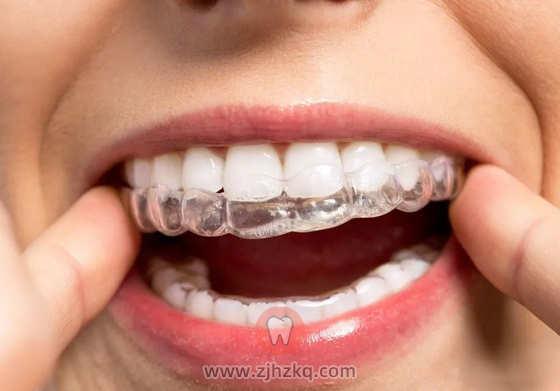 压膜保持器照片