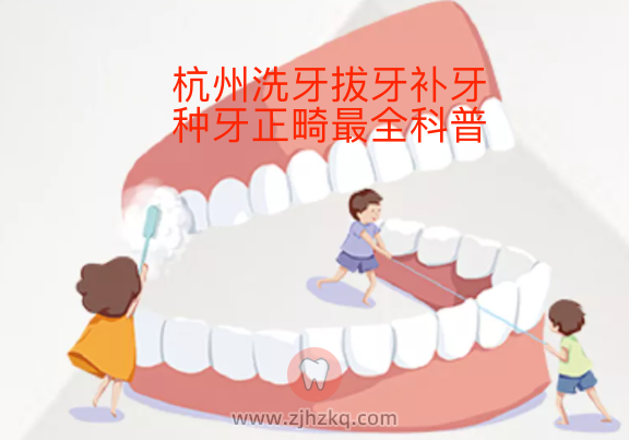 杭州洗牙拔牙补牙种牙正畸最全科普