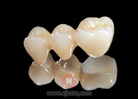 杭州口腔牙科推荐的全瓷牙好在哪里