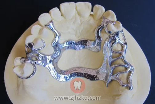 杭州地区维他灵支架价格表