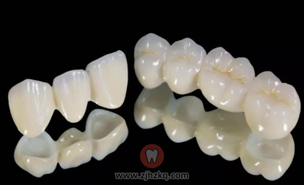 杭州进口全瓷牙价格表