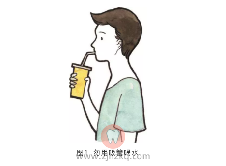 杭州口腔科普拔牙后为什么不能吐口水