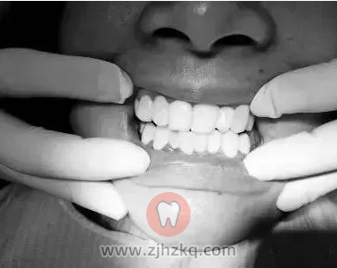 杭州口腔科普整牙美牙要选择杭州专业资质医院