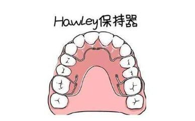 杭州口腔科普牙齿矫正保持器种类及价格