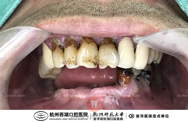 IMG_0809(20200915-143745)