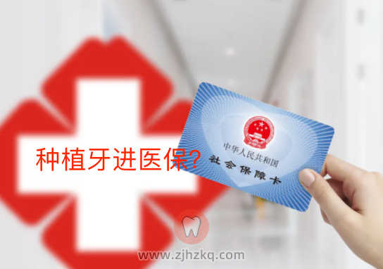 种植牙会不会纳入杭州医保报销范畴