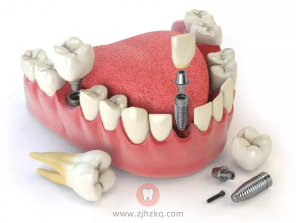 杭州正规种植牙医院或口腔医疗机构特点