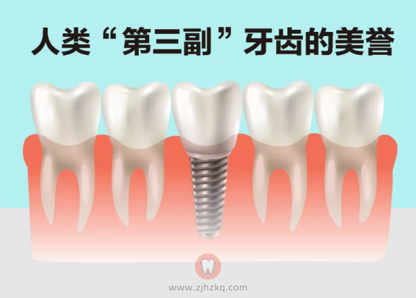 聊聊种牙什么是种植牙