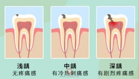 过了个年医生说我的牙不能补了？