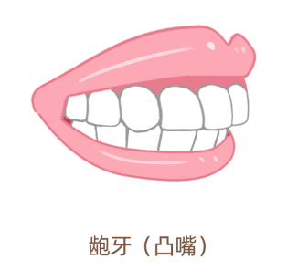 这五种人要做牙齿矫正附照片图片请照镜子自查