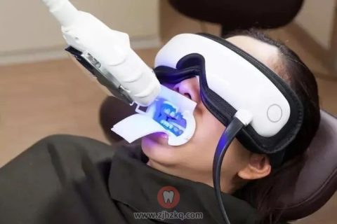 牙齿美白最有效安全的方法