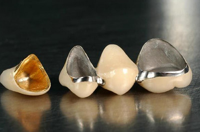 固定义齿（烤瓷牙）优点缺点整理