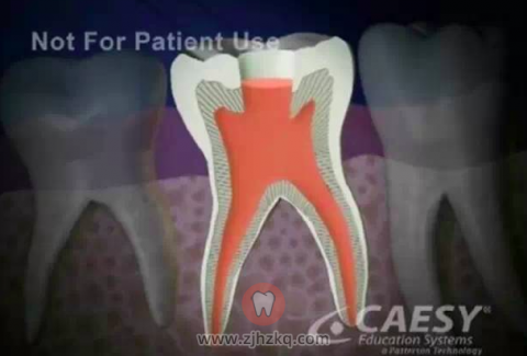 乳牙根管治疗有必要吗是否会影响恒牙