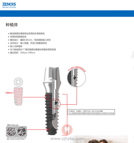 ZENOIS种植牙种植系统介绍