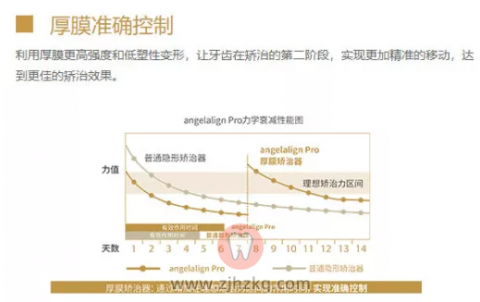 时代天使正畸牙套有没有必要选冠军版