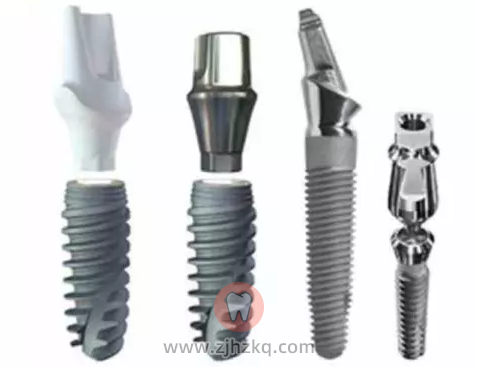 杭州种植牙品牌推荐