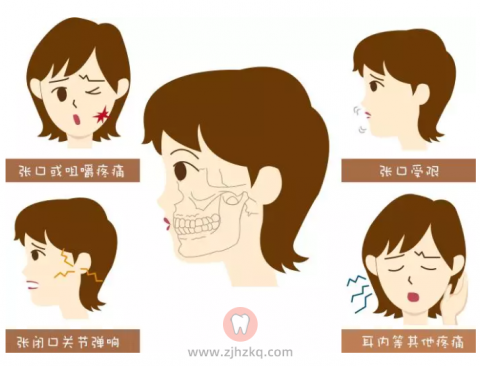 有些医生未必会告诉你的箍牙危害