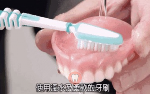 活动义齿（假牙）优点缺点整理