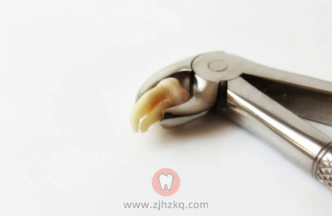 智齿反复发炎了不拔行不行