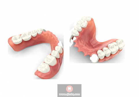 杭州医院选择哪种假牙比较好