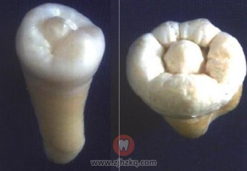 绍兴市**口腔科看牙记